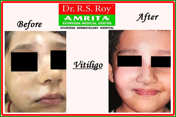 Dr R S Roy Amrita Ayurveda Medical Centre –  Thrippunithura